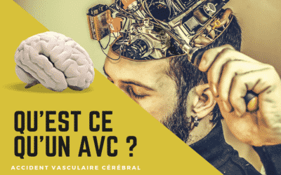 Qu’est ce qu’un AVC ?