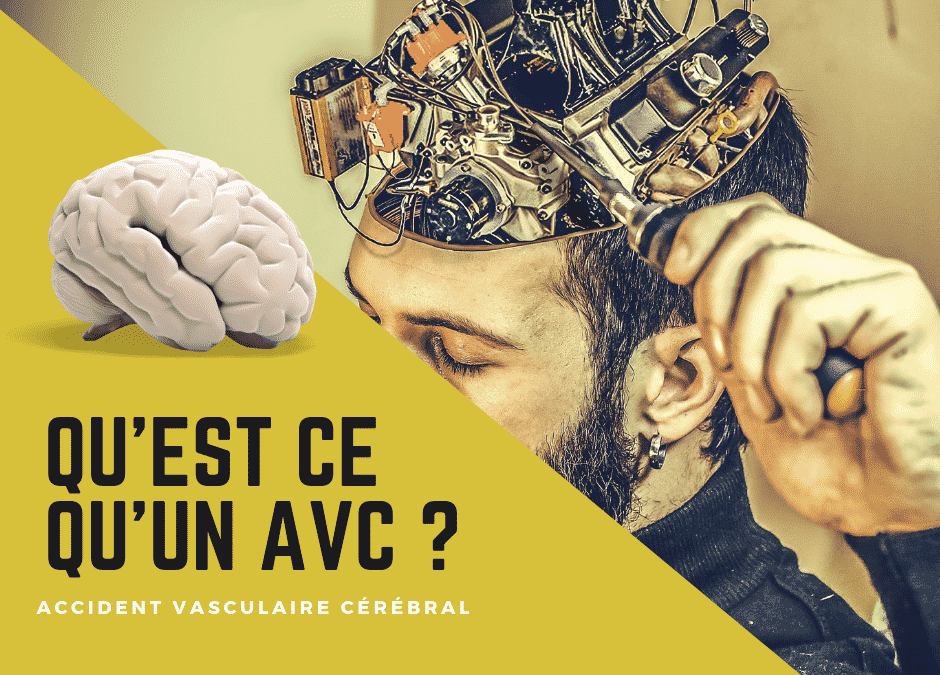 Qu’est ce qu’un AVC ?